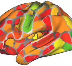 fcmri_indiv_diff_forweb-700x467.jpg