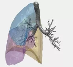 18_97_illustration_of_lung_structure_from_ct_scan_data_credit_university_of_southampton_web.jpg_sia_jpg_fit_to_width_inline.jpg