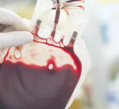 Blood transfusion