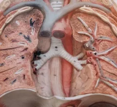 Lungs