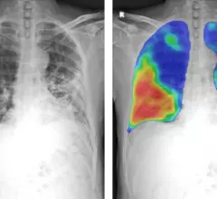 thirona x-ray image