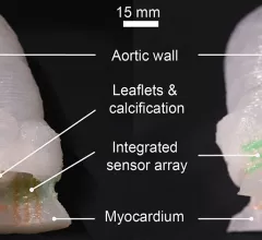 heart valve 3d printed