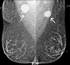 breast COVID-19 vaccination
