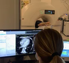 A cardiac CT scan being performed on a Cardiograph dedicated cardiac CT scanner at a Duly Health and Care outpatient clinic. Photo by Dave Fornell