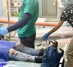 A pediatric patient who was wounded by Russian fire during fighting in Kyiv, Ukraine, being triaged at the National Children's Specialized Hospital. #Ukraine #UkraineRussianWarb #civiliancasualties