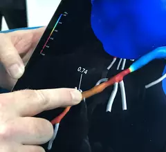 An example of HeartFlow's FFR-CT technology, which takes the cardiac CT dataset and uses computational fluid dynamics to create virtual fraction flow reserve values. The FFR measurement can help determine if a coronary lesion is significant enough to require revascularization, or if the patient should be treated with medication. FFR-CT was included as a recommendation in select patients in the 2021 Chest Pain Guidelines.