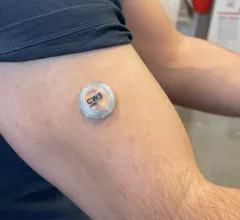 Engineers have developed and tested a new wearable device capable of monitoring a person’s blood sugar, alcohol and lactate levels all at the same time, detailing their work in Nature Biomedical Engineering