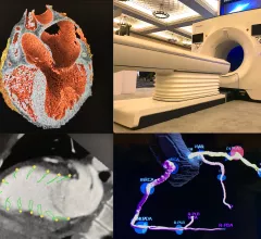 Examples of new cardiac CT technologies at the 2022 SCCT meeting. Top left clockwise, realistic 3D rendering inside the heart, the GE Revolution Apex scanner, Cleerly's AI automated soft plaque assessment, and CT strain imaging from Medis. #SCCT #SCCT2022 #YesCCT #CTA #CCTA, new computed tomography technology