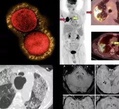 COVID-19 medical imaging examples of various clinical presentations. SARS-CoV-2 clinical imaging presentations.