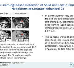 pancreas lesions on CT