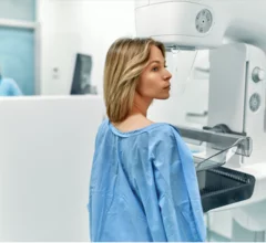 Example of a typical mammography imaging suite during a breast screening exam. The patient has their breast compressed by the clear plastic part of the mammography system. The compression is necessary to get diagnostic grade images. It also helps with getting consistent images, which is important because new exams are compared to prior exams to help identify any changes in the breast that may be due to cancer. The black base below the breast is the X-ray detector. What is involved in a mammogram?