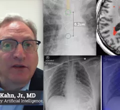 Charles E. Kahn, Jr., MD, MS, Editor of the the RSNA journal Radiology: Artificial Intelligence, and professor and vice chair of radiology at the University of Pennsylvania Perelman School of Medicine, discusses trends in radiology medical imaging AI. He has been heavily involved in radiology informatics and has seen up close the evolution of radiology toward deeper integration with AI. #RSNA22