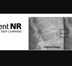 Intelligent NR Canon RSNA 2022