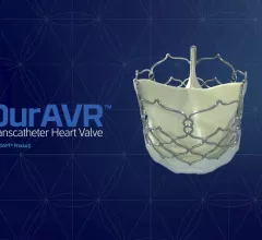 Anteris Technologies duravr heart valve