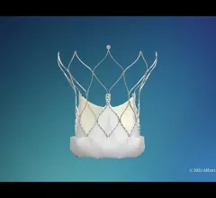 Abbott has gained U.S. Food and Drug Administration (FDA) approval for its Navitor transcatheter aortic valve replacement (TAVR) system, the company’s new self-expanding valve for high-risk patients with severe symptomatic aortic stenosis. 