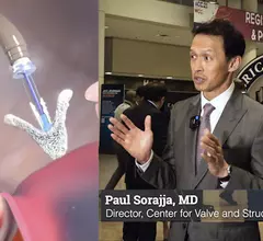 Paul Sorajja, MD, director, Center for Valve and Structural Heart Disease, Minneapolis Heart Institute, Abbott Northwestern Hospital, was the principal investigator for the late-breaking TRILUMINATE pivotal trial at the American College of Cardiology (ACC) 2023 meeting and explains details of this landmark trial. #ACC #ACC23 #triluminate