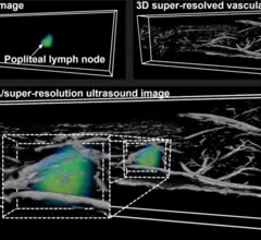 dual modality super resolution ultrasound imaging