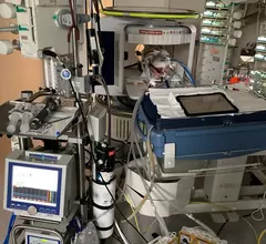 portable MRI in pediatric ECMO setting