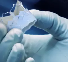 The DurAVR transcatheter heart valve (THV), developed by Minnesota-based Anteris Technologies
