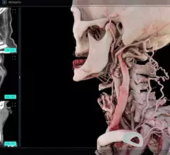 medivis SurgicalAR 