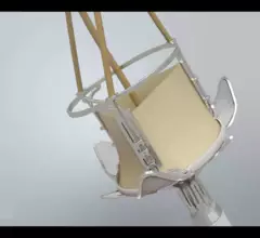 Valve Medical's Xemed TAVR valve