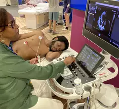 Patient being scanned on Philips Epiq ultrasound cardiac echo ASE 2023.