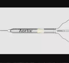 Procyrion's Aortix percutaneous mechanical circulatory support (pMCS) device