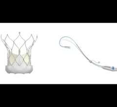 Abbott's Navitor TAVR valve