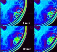 time-delayed MRI phases improve brain tumor visualization