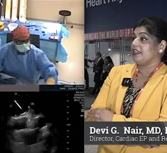 Video interview with Devi Nair, MD, who explains how to go fluoroless in PFA procedures. #HRS #HRS24 #HRS2024 #0Fluoro #zerofluoro #EPeeps