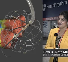 Video interview with Devi Nair, MD, who shares her experience of using the Sphere-9 PFA system in the FDA IDE late-breaking trial at HRS24. #HRS #PFA #HRS2024