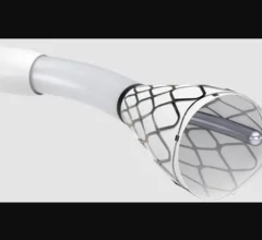 Hēlo PE Thrombectomy System developed by U.S. medical device company Endovascular Engineering.