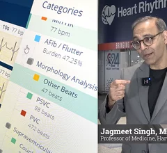 Jagmeet Singh, MD, PhD, Professor of Medicine, Harvard Medical School, and Founding Director of the Resynchronization and Advanced Cardiac Therapeutics Program at Mass General Hospital, delivered a key note address at HRS 2024 on the future of artificial intelligence in EP and AI applications in cardiology. #HRS #EPeeps #HRS2024 #HRS24 #HealthAI