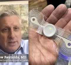 Video interview with Matthew Reynolds, MD, who shares data on largest wearable ambulatory cardiac monitoring studies to date from the EXCALIBER and CAMELOT trials at HRS 2024. #HRS #HRS2024 #Remotemonitoring