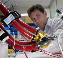 Surgeons in Houston have performed the world’s first successful human implant of BiVACOR’s Total Artificial Heart (TAH) technology. The procedure was completed July 9, 2024, at The Texas Heart Institute at Baylor St. Luke’s Medical Center. It was part of an early feasibility study (EFS) first approved by the U.S. Food and Drug Administration (FDA) back in December 2023. 