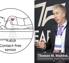 Thomas Maddox, MD, explains some of the new, innovative technologies people should watch for in cardiology. He said some of these may define how cardiologist practice medicine in the next couple years.