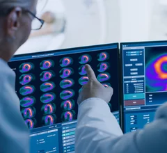 New PET radiotracer for detection of CAD approved by FDA.