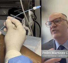 Pedro Martinez Clark, MD, explains treatment options for peripheral artery disease (PAD) patients.