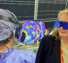 A demonstration of SenitAR's augmented reality (AR) technology for electrophysiology lab procedures during the Heart Rhythm Society 2024 meeting. This is one of at least six FDA-cleared clinical AR and virtual reality applications that aimed at enhancing cardiology workflow and patient outcomes. Photo by Dave Fornell