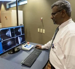 Breast CT University of Arizona Srinivasan Vedantham