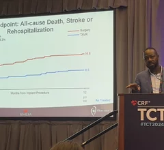 Didier Tchetche, MD, an interventional cardiologist and head of the structural heart disease program at Clinique Pasteur in Toulouse, France, and colleagues combined data from the RHEIA and PARTNER 3 trials into a single comparison of TAVR outcomes in female patients. 