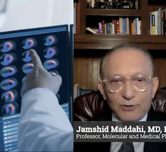 Video of Jamshid Maddahi, MD, UCLA, explaining why flurpiridaz will change cardiac imaging and increase the adoption of PET cardiac imaging.