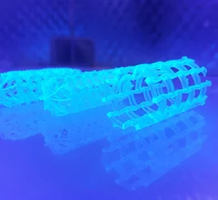 Massachusetts Institute of Technology won a $50,000 award to help commercialize its 3D printed, polymeric auxetic stent to treat pediatric aortic coarctation. It is bioresorbable so the patient can continue to grow without the need for as many reinterventions.
