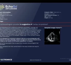 Ultromics EchoGo Amyloidosis artificial intelligence