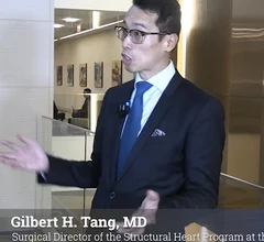Gilbert Tang, MD, explains new tricuspid TEER TRILUMINATE data that now shows clinical efficacy.