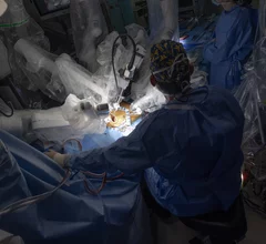 Robotic aortic valve replacement (RAVR) is a new minimally invasive treatment option for symptomatic severe aortic stenosis (AS) that uses advanced robotic surgical systems. It has already started gaining momentum as an alternative to both surgical aortic valve replacement (SAVR) and transcatheter aortic valve replacement (TAVR). 