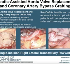 Back in October 2024, heart surgeons with the WVU Heart and Vascular Institute in Morgantown, West Virginia, performed the world’s first robotic aortic valve replacement and coronary artery bypass (RAVCAB) procedure. Now, the team behind that historic surgery has shared its full story for the first time, publishing an in-depth look at the procedure in The Annals of Thoracic Surgery, an official journal from the Society of Thoracic Surgeons.[1]