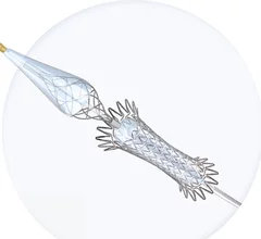 Medtronic entered into an exclusive U.S. distribution agreement with Contego Medical for carotid and peripheral vascular disease revascularization products and includes option to acquire the company.