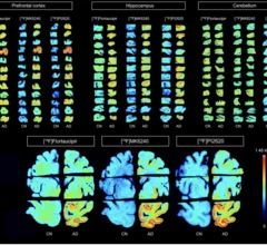 New radiotracers outperform FDA-approved agent for detection of tau tangles.