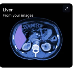 PocketHealth's Image Readers helps patients understand their radiology report findings.